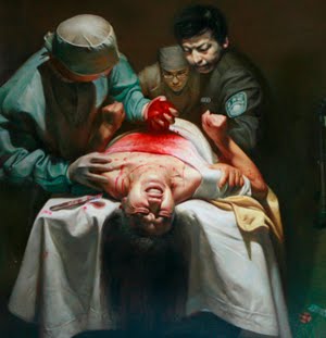 ORGANHARVESTING surgeons